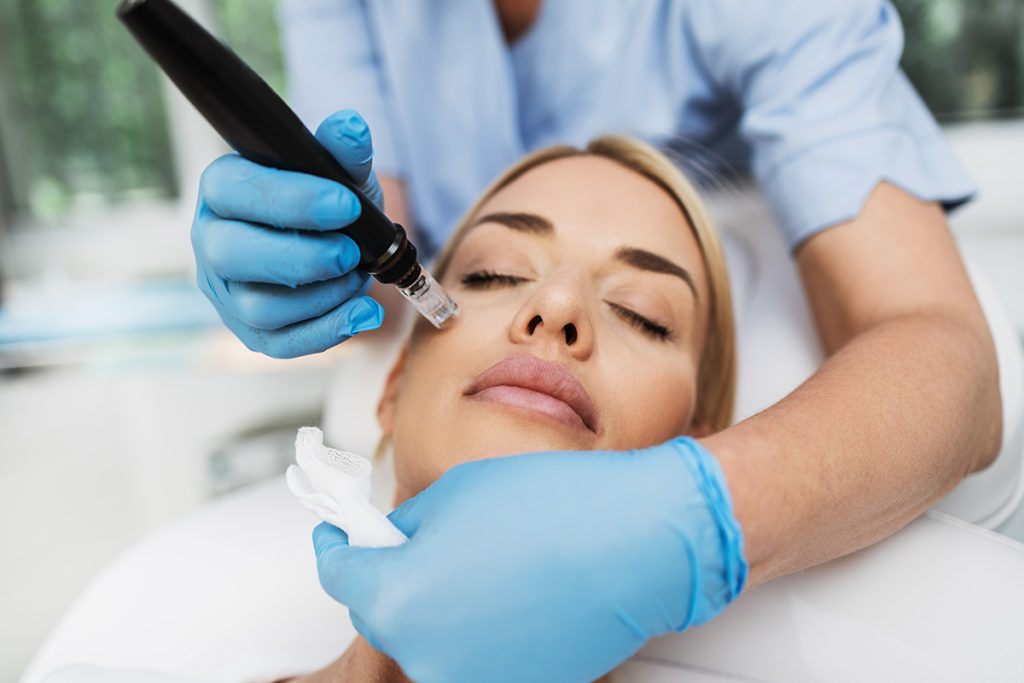 Microneedling-chirurgien-esthetique-lekieffre